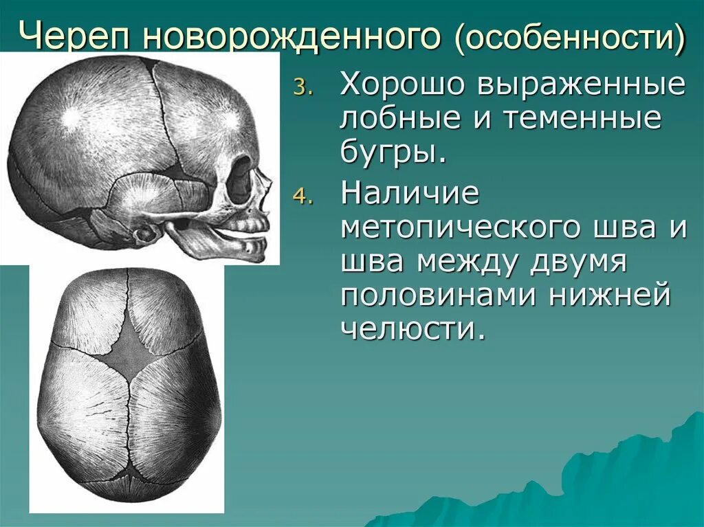 Швы костей черепа анатомия. Роднички черепа анатомия. Роднички черепа новорожденного. Череп новорожденного анатомия.