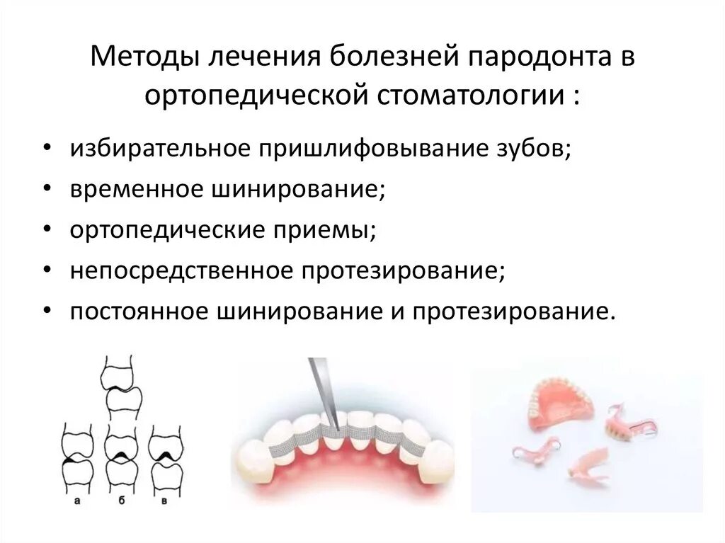 Методы лечения пародонта