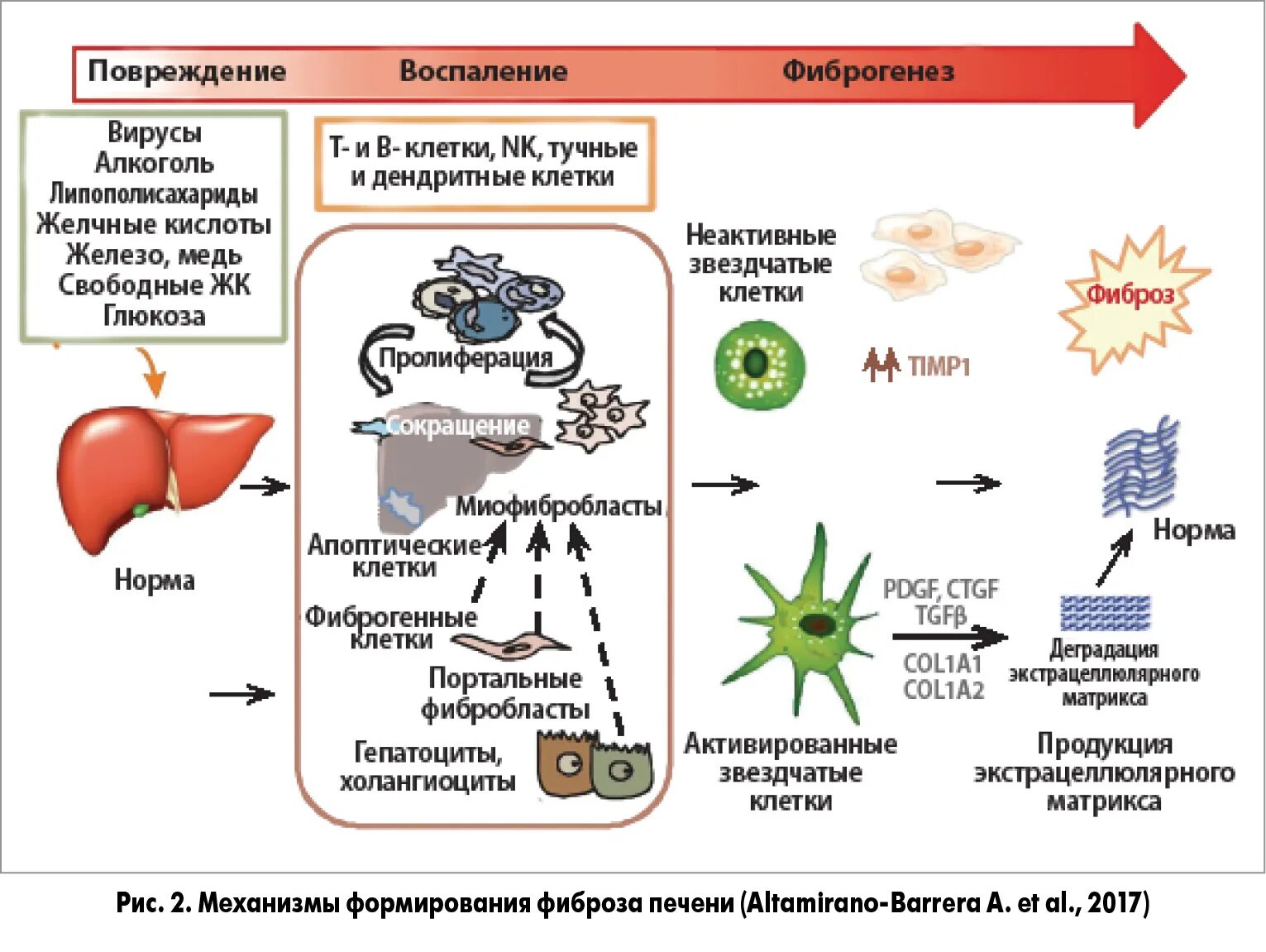 Механизм развития фиброза печени. Патогенез фиброза печени. Механизм развития цирроза печени клетки.