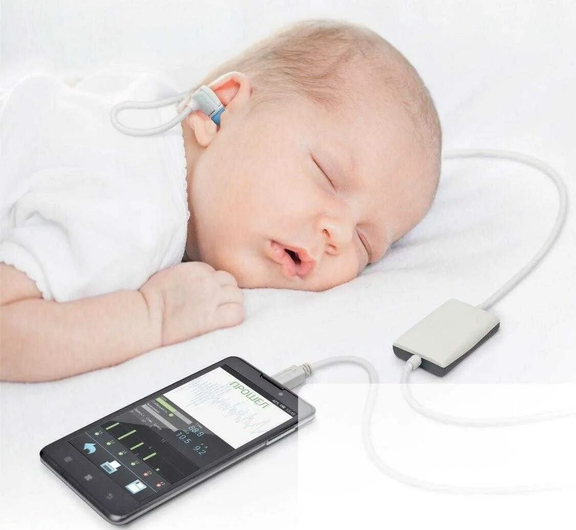 Исследование коротколатеральных вызванных потенциалов. Аудиологический скрининг новорожденных. Аппарат для проверки слуха у новорожденных. Исследование коротколатентных слуховых вызванных потенциалов ксвп. Исследование слуха у детей раннего возраста.