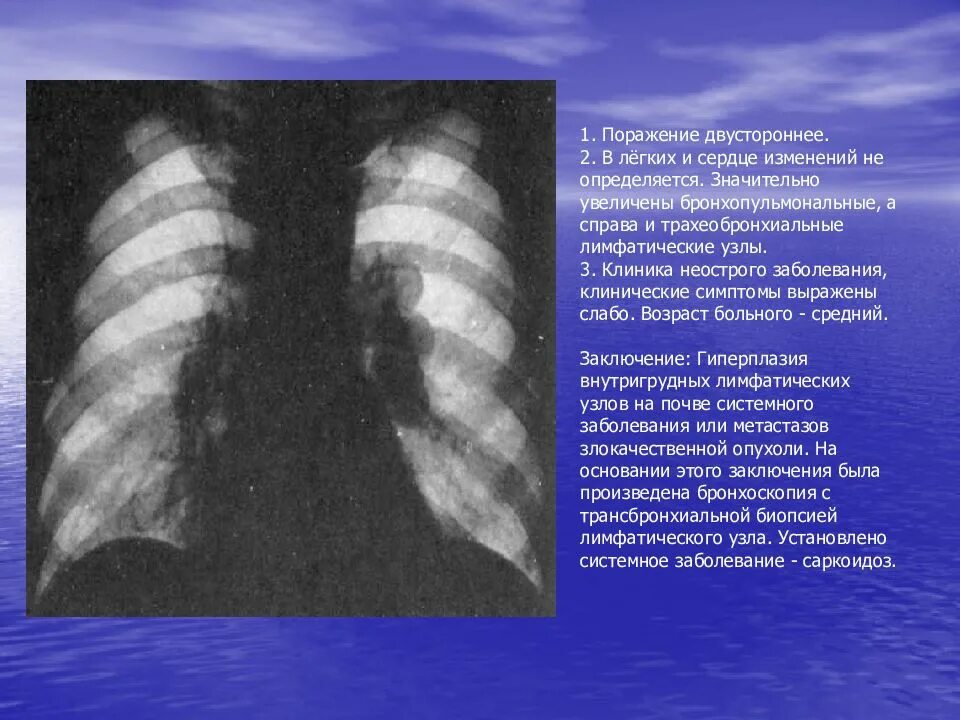 1 поражения легких