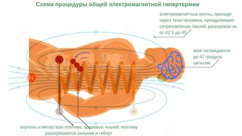 Общая процедура это