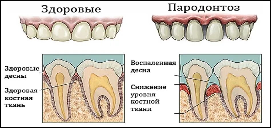 Что хорошо зубы и десны