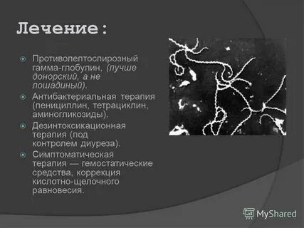 Гамма преза