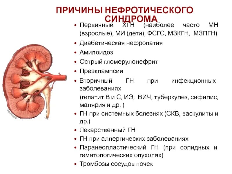 Умеренное изменение почек. Хронический гломерулонефрит нефротический форма. Мкб 10 пиелокаликоэктазия почки у детей. Симптомы нефропатии нефропатия почек. Острый гломерулонефрит нефротическая форма.