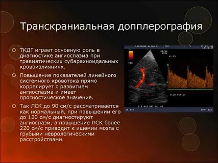 Допплерография в москве