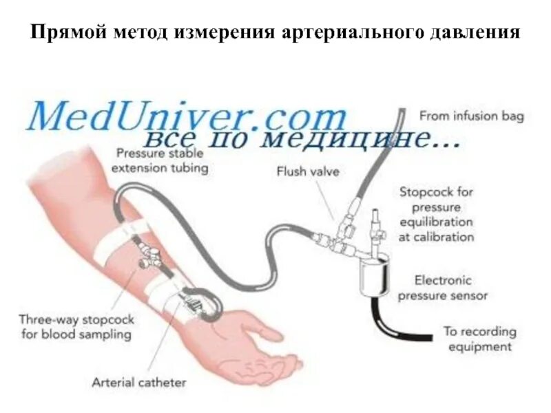 Алгоритм измерения артериального. Прямой метод измерения артериального давления. инвазивное измерение артериального давления. инвазивное артериальное давление методика измерения. инвазивный (прямой) метод измерения ад.