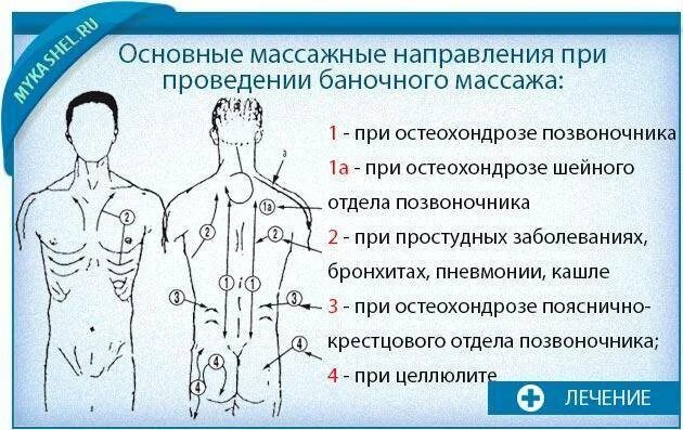 Банки при кашле взрослому как правильно. Как правильно устанавливать вакуумные банки. Вакуумные банки схема постановки на спине. Баночный массаж спины схема. Куда ставить вакуумные банки на спину схема.