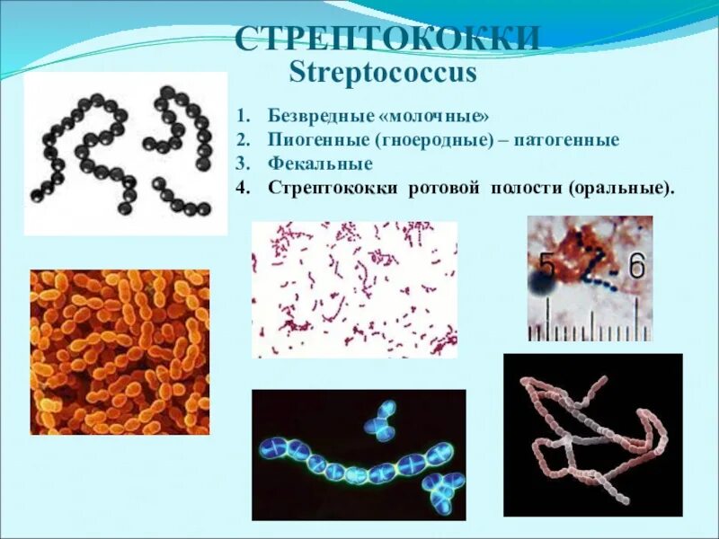 Стрептококки представители. Цитолитический стрептококк. Бактерии кокки стрептококки. Бактерия стрептококк группы а.