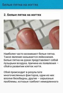 Что значит белая точка на ногте
