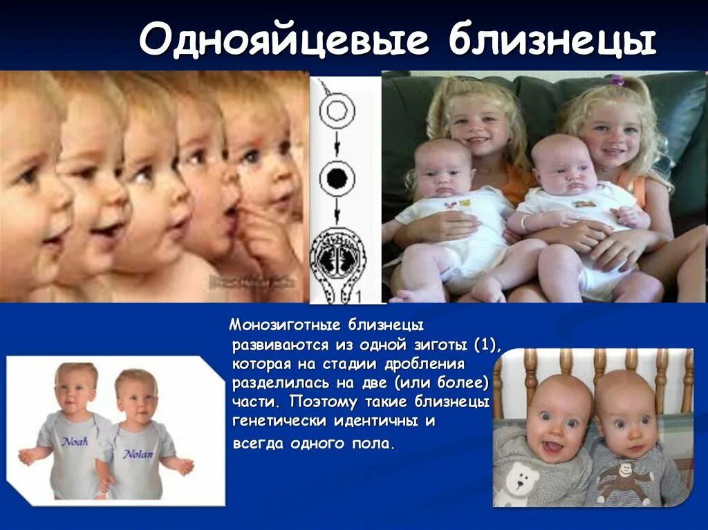 Совпадение признаков у однояйцевых и разнояйцевых близнецов
