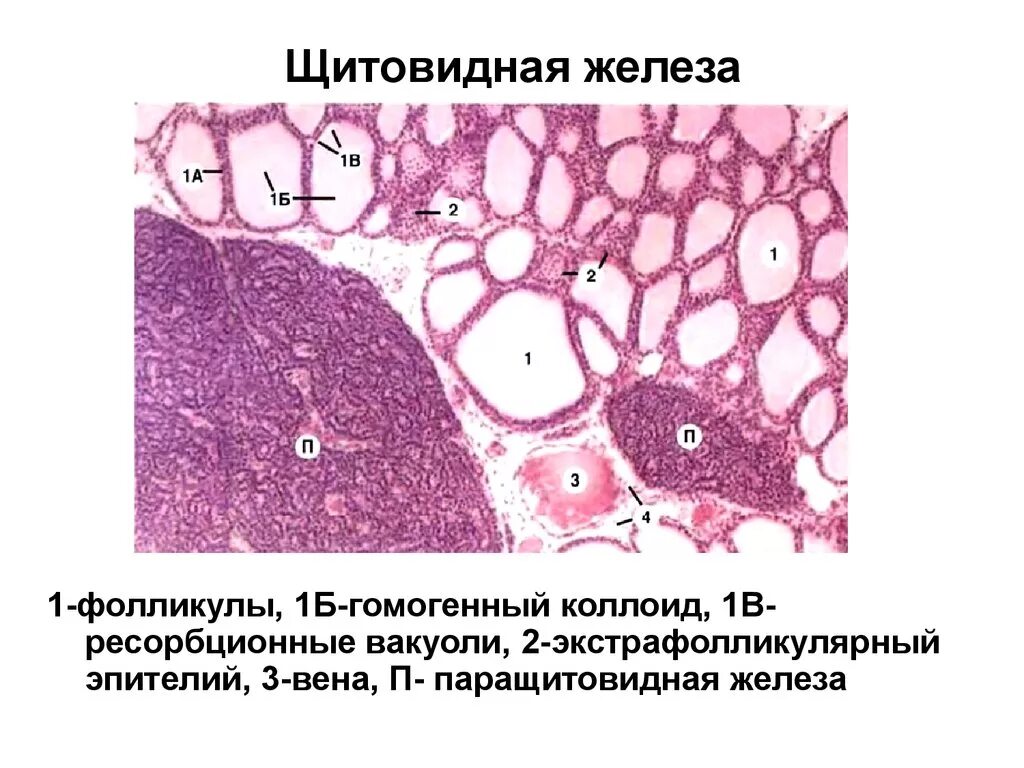 Ткань щитовидной железы микропрепарат. Строение щитовидной железы микропрепарат. Щитовидная железа гистология препарат. Срез щитовидной железы гистология.