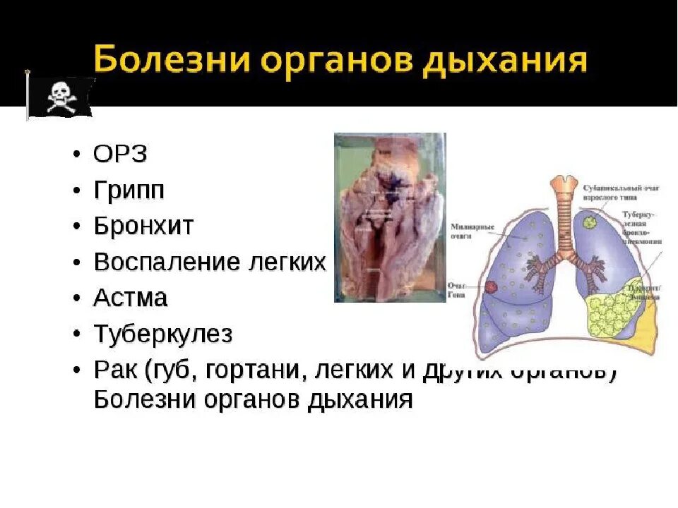 Заболевания органов дыхания. Болезни дыхательных органов. Заболевания органов дыхательной системы. Презентация на тему заболевания органов дыхания.