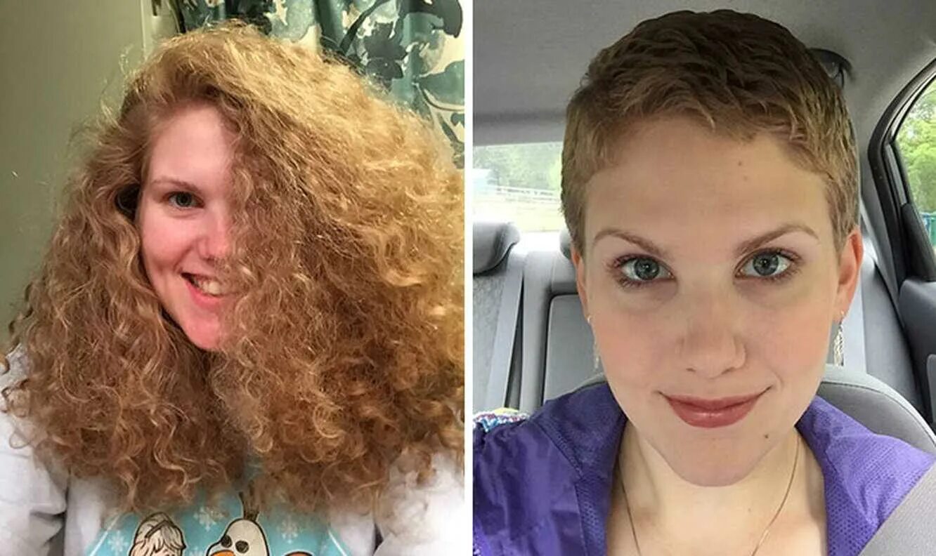 Какие волосы после химиотерапии. Состричь сожженные волосы. Волосы после химиотерапии. Стрижка сожженных волос до и после. Девушки в париках до и после.