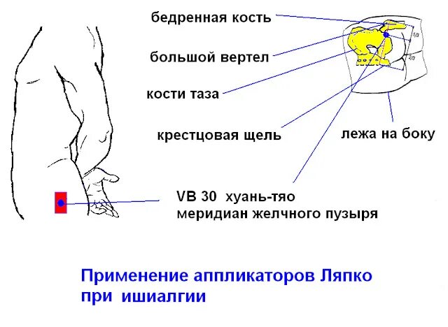 Какую точку надо выбрать васе
