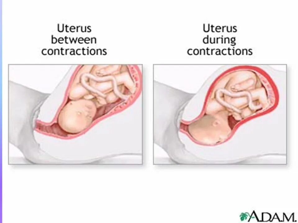 Ванна в первом триместре. Тонус матки у беременных. Тонус матки при беременности. Тонус второй триместр. Гипертонус беременной.