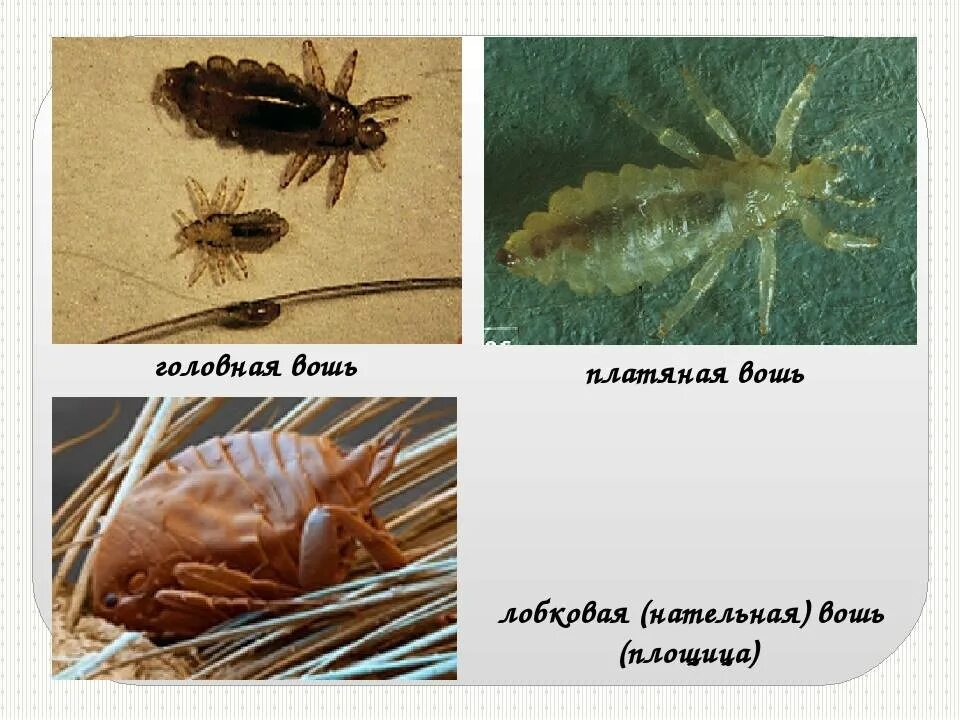Вши чесотка