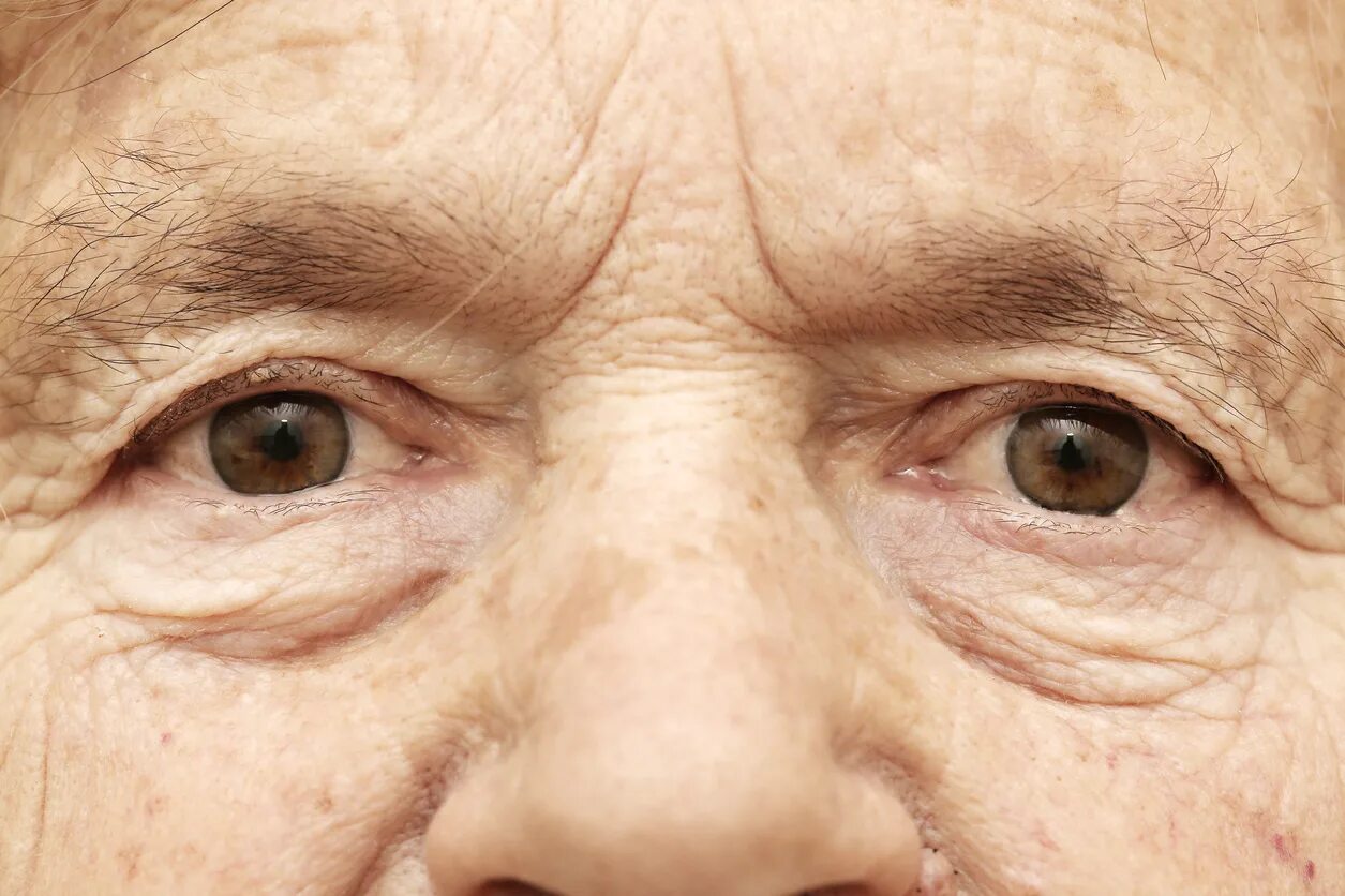 Мордочка сморщенная старушечья а глазки живые блестящие. Шарик на лице у пожилых людей.