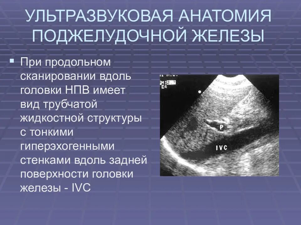 УЗИ поджелудочной железы. Ультразвуковая анатомия поджелудочной железы. Фуци поджелудочной железы. Ультразвуковое исследование поджелудочной железы.