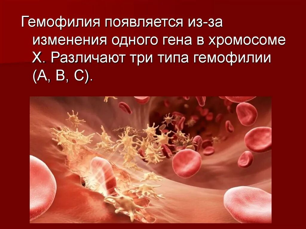 Гемофилия этиология. Гемофилия свертывание крови. Гемофилия наследственная болезнь