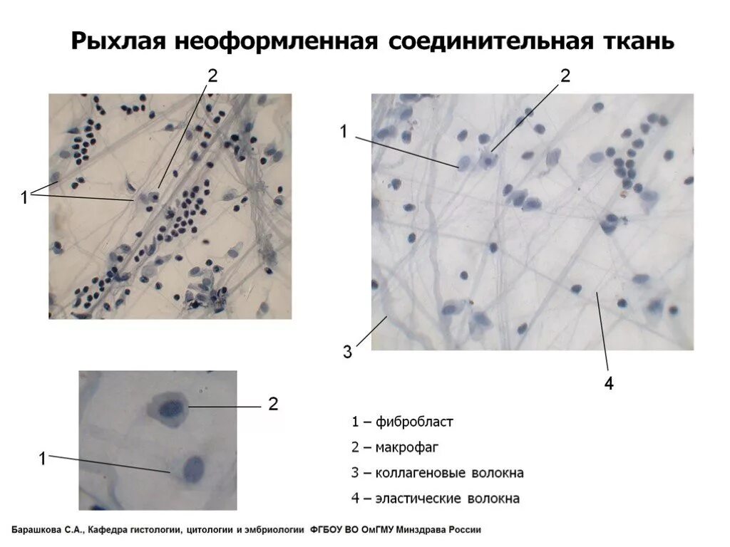 Рыхлая волокнистая соединительная ткань фиброциты. Рыхлая волокнистая соединительная ткань гистология. Рыхлая волокнистая неоформленная соединительная ткань гистология. Фибробласты рыхлой соединительной ткани. Макрофаги препарат