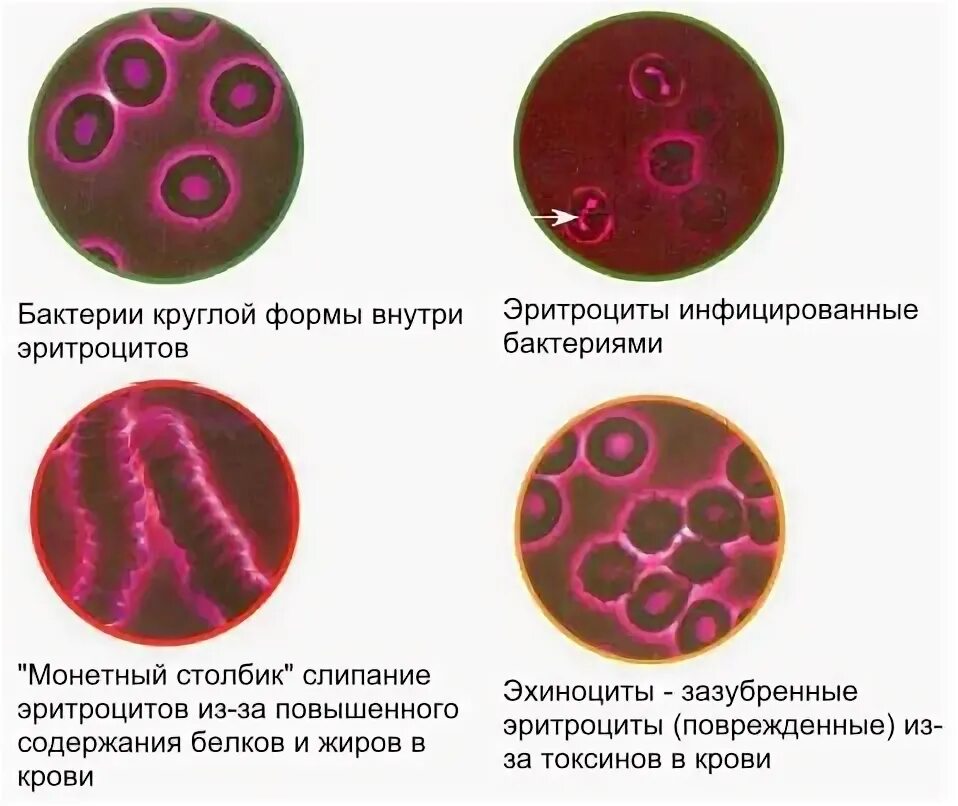 Бактерии округлой формы. Кровь в темнопольном микроскопе. Капля крови на темнопольном микроскопе. Исследование крови под микроскопом. Эритроциты поврежденные.