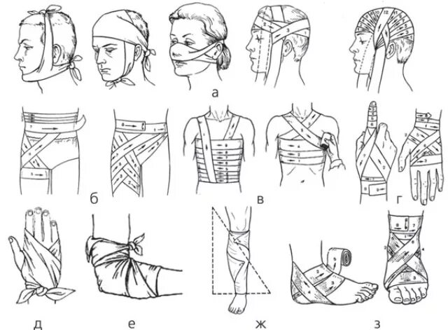Бинтовая повязка алгоритм. Техника бинтования десмургия. Десмургия восьмиобразная повязка. Десмургия основные типы повязок. Повязки десмургия правила наложения повязок.