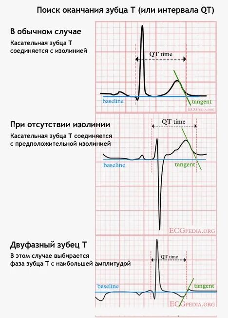 Удлинение корригированного qt