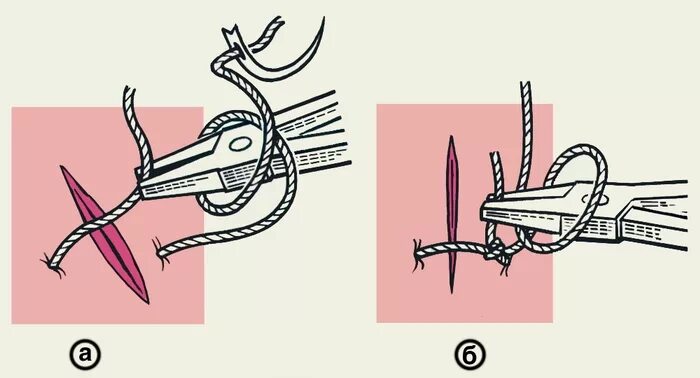 Х образный шов. Хирургический шов 1 ниткой. Техника наложения швов в хирургии. Техника завязывания хирургического шва.