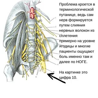 Диклофенак при защемлении седалищного нерва