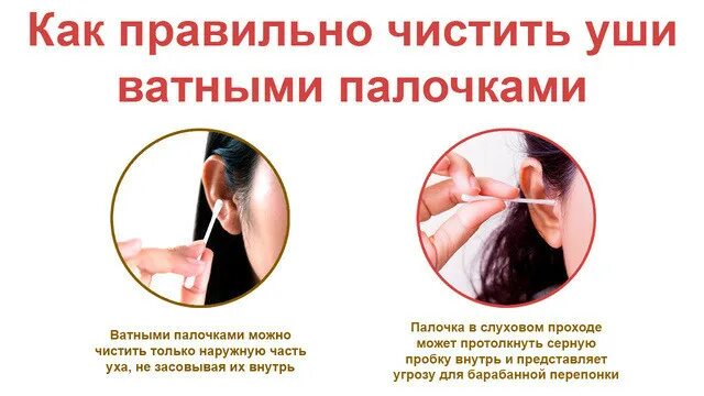 Как безопасно почистить уши от серы. Как и чем правильно чистить уши. как правильно чистить уши взрослому.