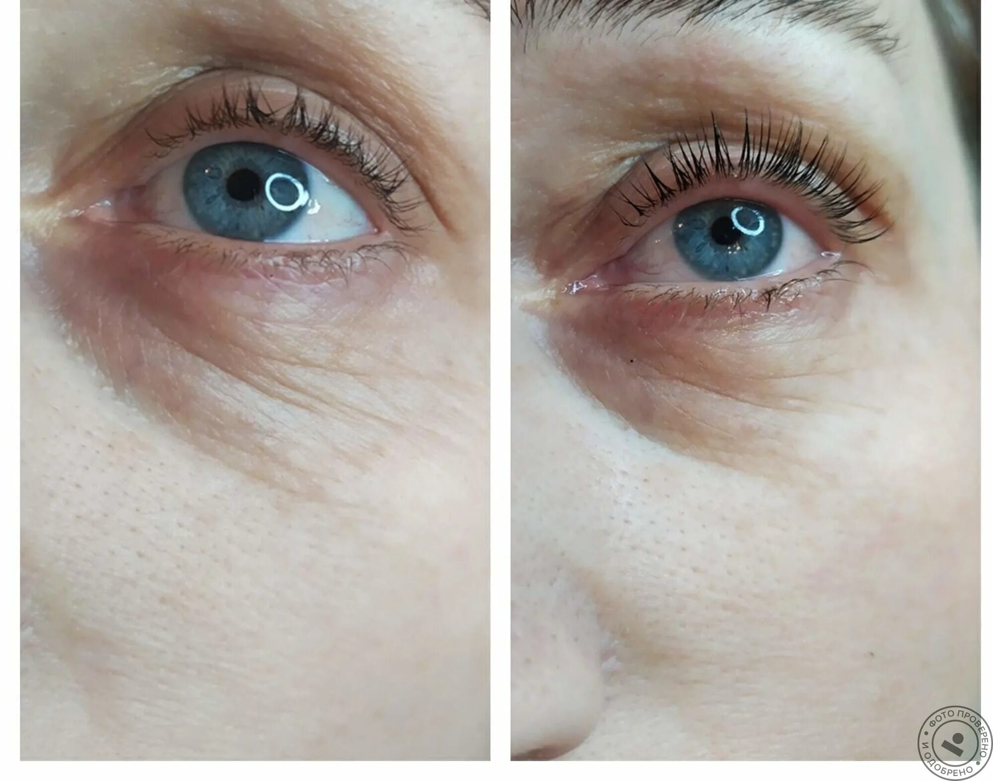 Ламинирование ресниц на нависшем веке. Ламинирование ресниц на нависшее веко. Нарощенные ресницы для опущенного века. Ламинирование ресниц азиатских глаз. Наращивание ресниц на опущенное веко.