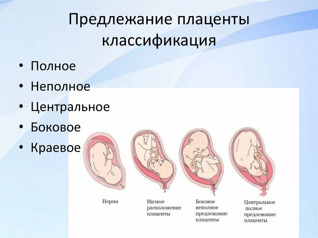 Краевое боковое центральное низкое предлежание плаценты. Центральное прикрепление плаценты при беременности. Степени предлежания плаценты. Краевое предлежание плаценты симптомы. 13 неделе беременности плацента