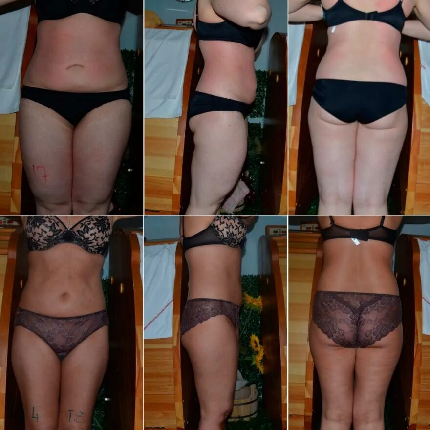 программа по бегу для начинающих. диета на 10 дней. диета правильное питание. бег план тренировок для начинающих. как быстро похудеть за неделю.