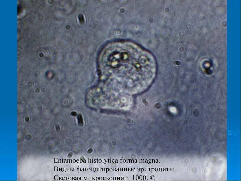 Entamoeba histolytica циста. Цисты Entamoeba. Entamoeba histolytica в микроскоп. Entamoeba coli в кале