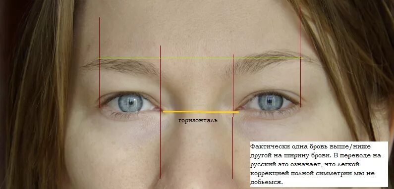 Неровные брови одна. Брови одна выше другая ниже. Асимметрия глаз и бровей. Неровные брови одна выше. Почему одна бровь выше
