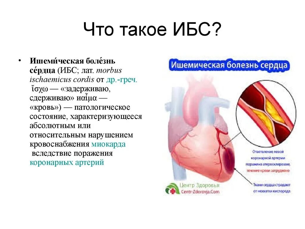 Чем опасна ишемия. Ишемическая болезнь сердца болезни.