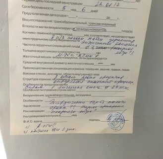 Анализ выкидыша