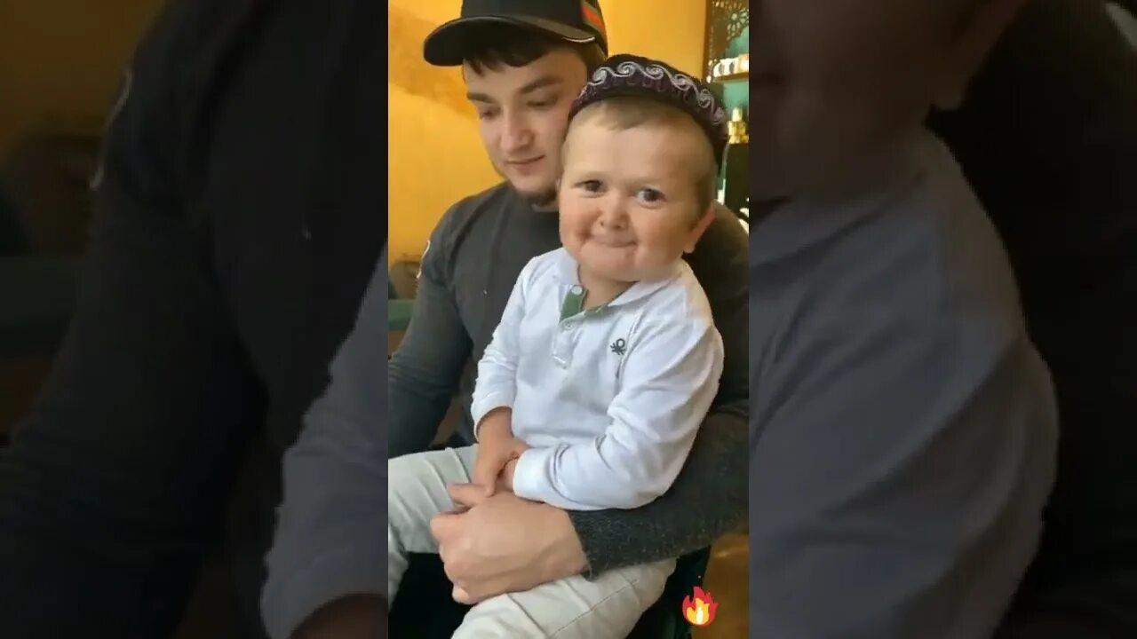 Али магомедов карлик. Семья хасбика. Хасбик. Сестра хасбика двойняшка. Хасбула магомедов хасбик.