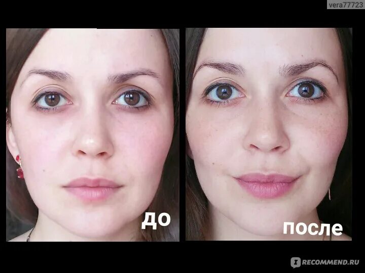 Эффект микро. Микротоки для лица LJ gjckt. Микротоки для лица до и после. Лицо до и после микротоков. Микротоковая терапия для лица до и после.