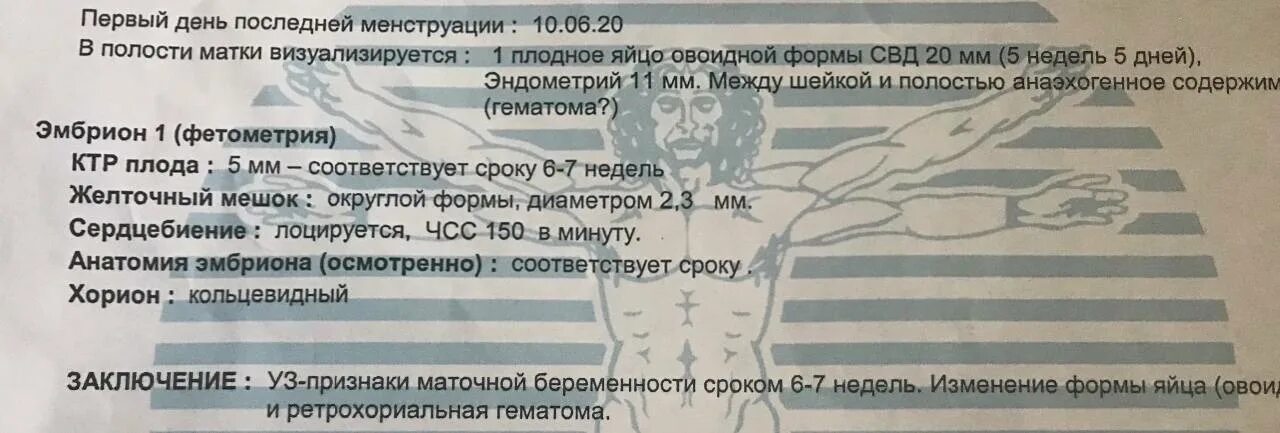Как выходит гематома при беременности сроки. Ретрохориальная гематома узи заключение. опорожнение ретрохориальной гематомы. ретрохориальная гематома узи протокол. ретрохориальная гематома выделения.