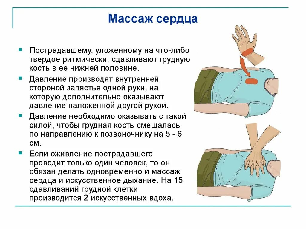 Как проводится непрямой массаж сердца. Алгоритм проведения наружного непрямого массажа сердца. Непрямой массаж сердца техника выполнения 1. Принцип оказания первой помощи непрямой массаж сердца. Как правильно делать закрытый массаж сердца.