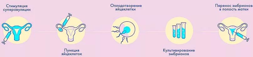 Пересадка эко