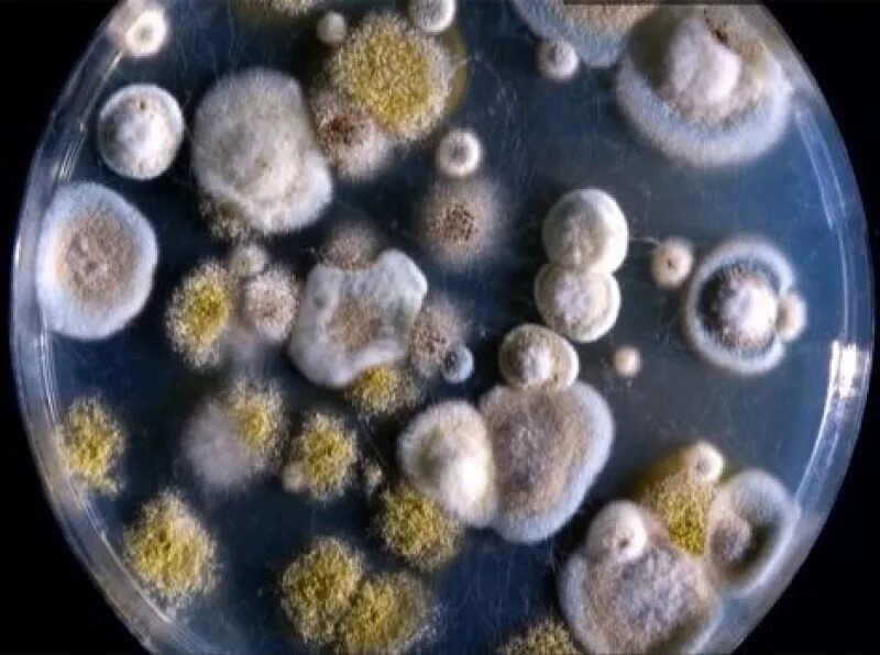 Хитридиомицеты плесень. Плесневые грибки в организме. Плесневые грибы в организме. Грибковые бактерии. Плесень коляска