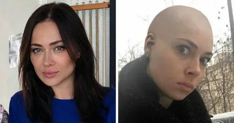 После стрижки налысо
