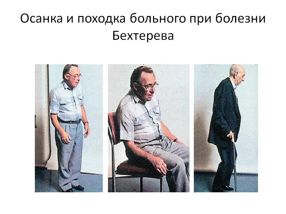 Правильная ходьба. Осанка походка. Правильная осанка при ходьбе. Правильная осанка в положении стоя. Жестикуляция осанка походка.