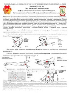 Признаки кровотечения из крупной артерии сдо