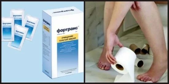 Стул после фортранса