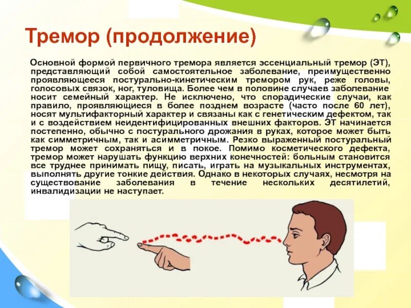 Эссенциальный тремор головы. Эссенциальный тремор го. Эссенциальный тремор препараты. Эссенциальный тремор рук причины.