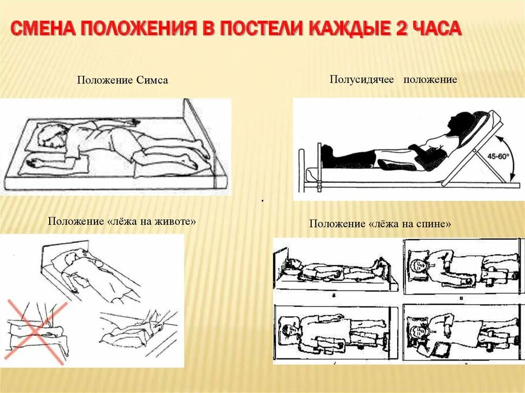 Метод изменения позиции. Пролежни положение Фаулера и симса. Положение Фаулера и положение симса. Положение пациента Фаулера и симса. Пролежни положение Фаулера.